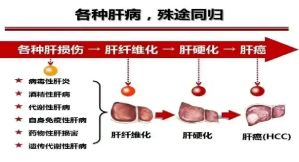 2024年世界肝炎日┃“肝”貨知識(shí)