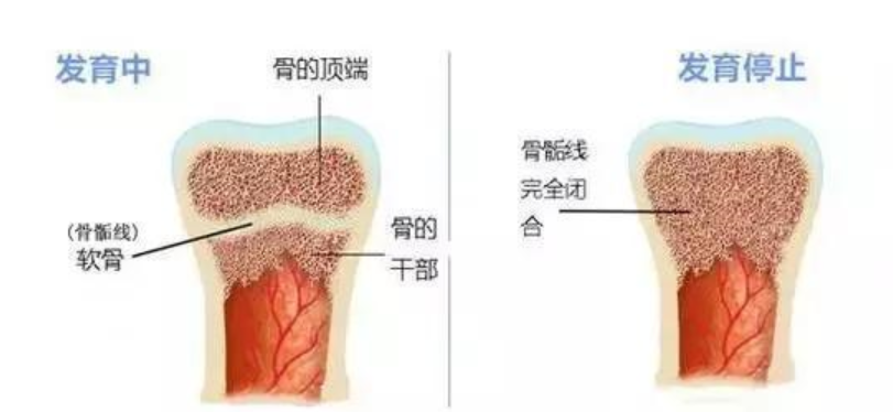 你家孩子又長高了嗎？