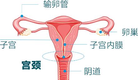 國際HPV知曉日| HPV早了解，宮頸癌早遠(yuǎn)離